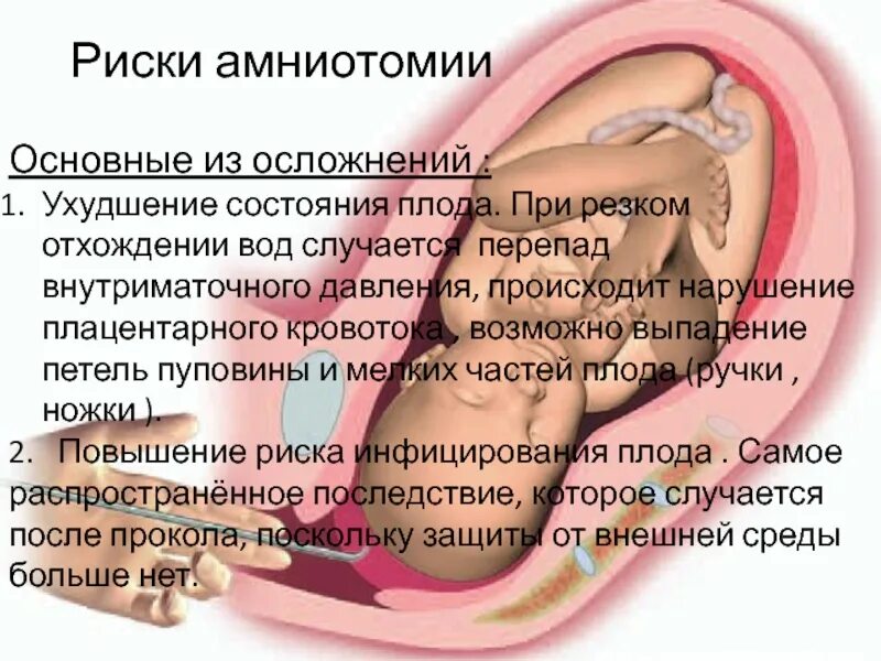 Гемодинамика при беременности. Нарушение кровотока плода. Кровоток в пуповине при беременности. Нарушение плацентарного кровообращения. Нарушение пуповинного кровотока.