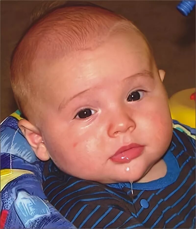 Пенистая слюна у малышей. Детская слюна. Слюни у ребенка в 1. Слюни у ребенка в 1. Младенец с открытым ртом.