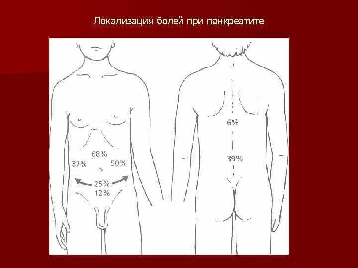 Панкреатит локализация боли. Хронический панкреатит локализация боли. Локализация боли при панкреатите. Локализация боли поджелудочной железы.