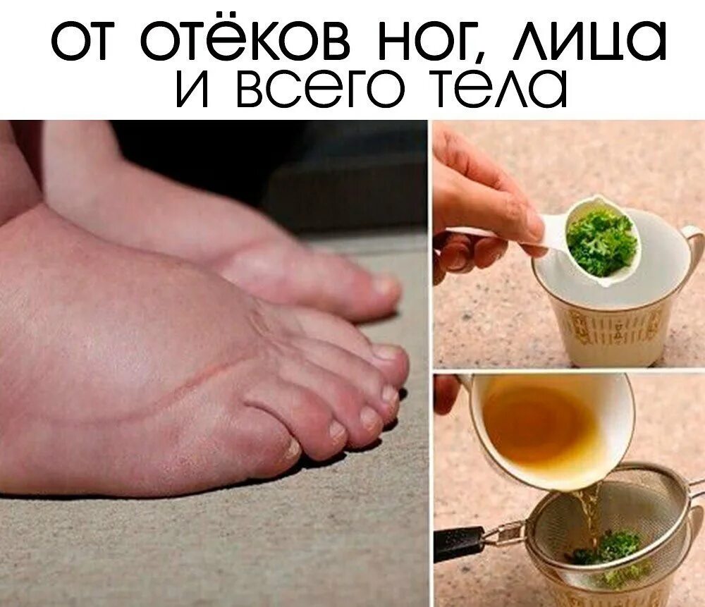 Отеки народные