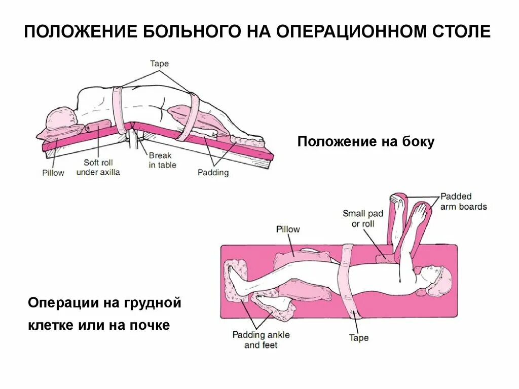 Положение больного на столе. Положение на операционном столе. Позиции на операционном столе. Расположение пациента на операционном столе обусловлено. Позиции пациента на операционном столе.