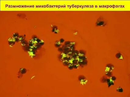 Размножение возбудителя