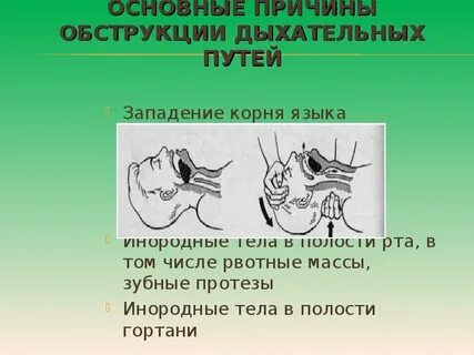 Обструкция дыхательных путей это