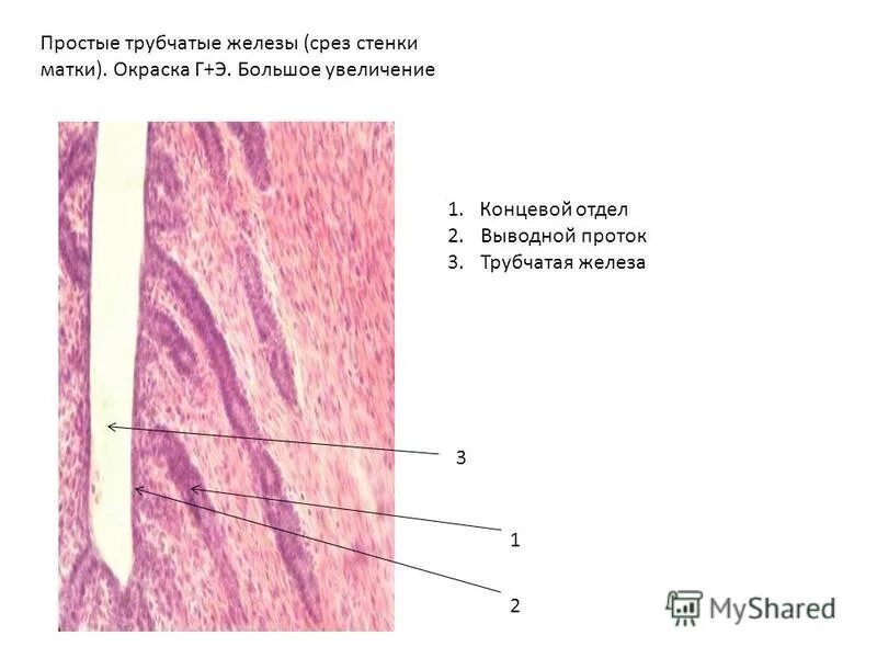 Увеличение больших половых