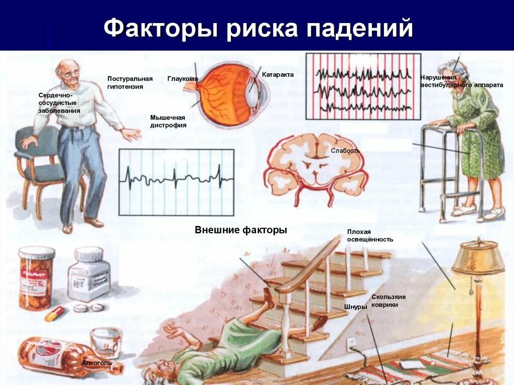 Риск падения. Шкала рисков падения пациентов. Факторы риска падений. Факторы риска падений пациента в стационаре.