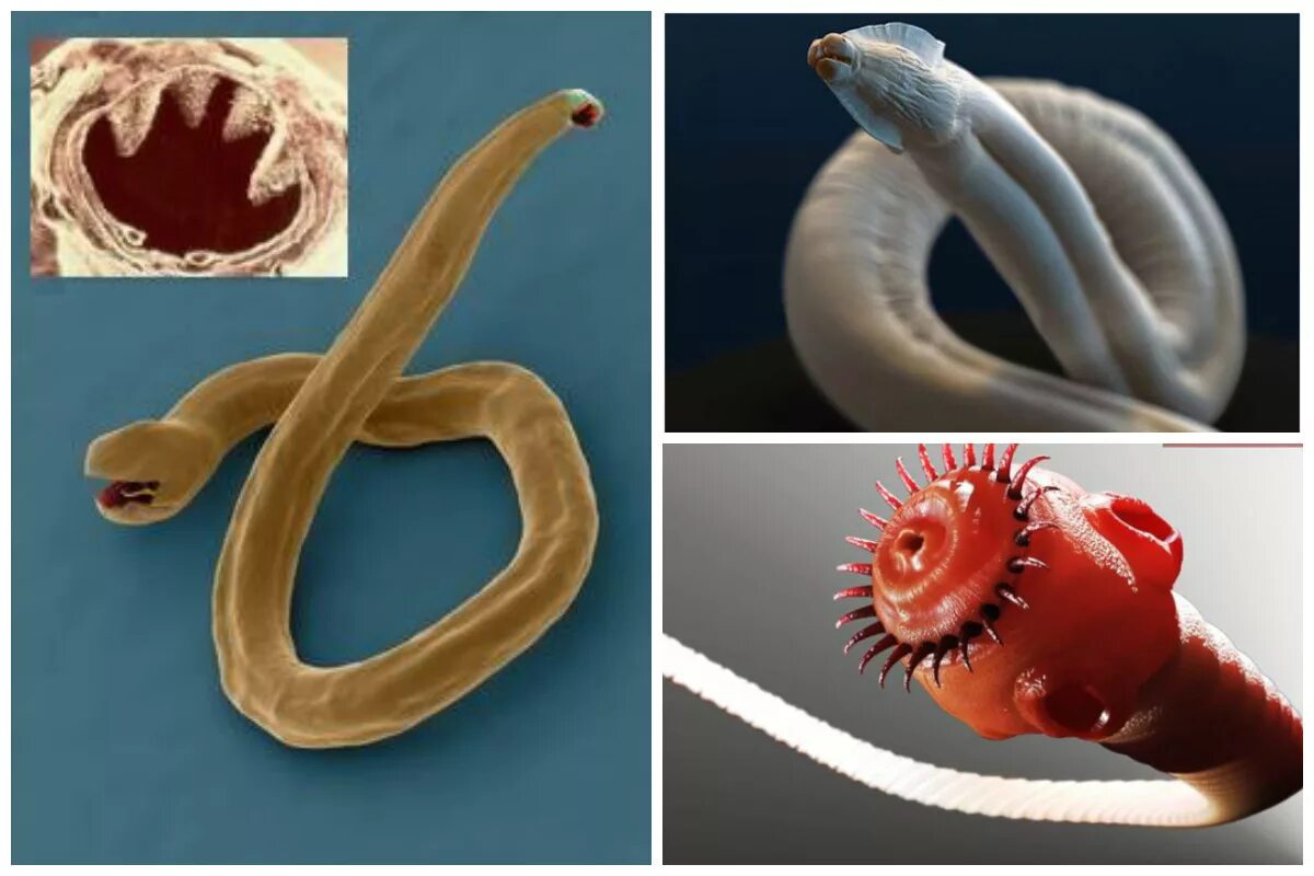 Гельминты паразитические черви. Гельминты паразитические черви у человека. Кишечные паразитические черви. Черви в организме человека гельминты. Строение внутренних паразитов