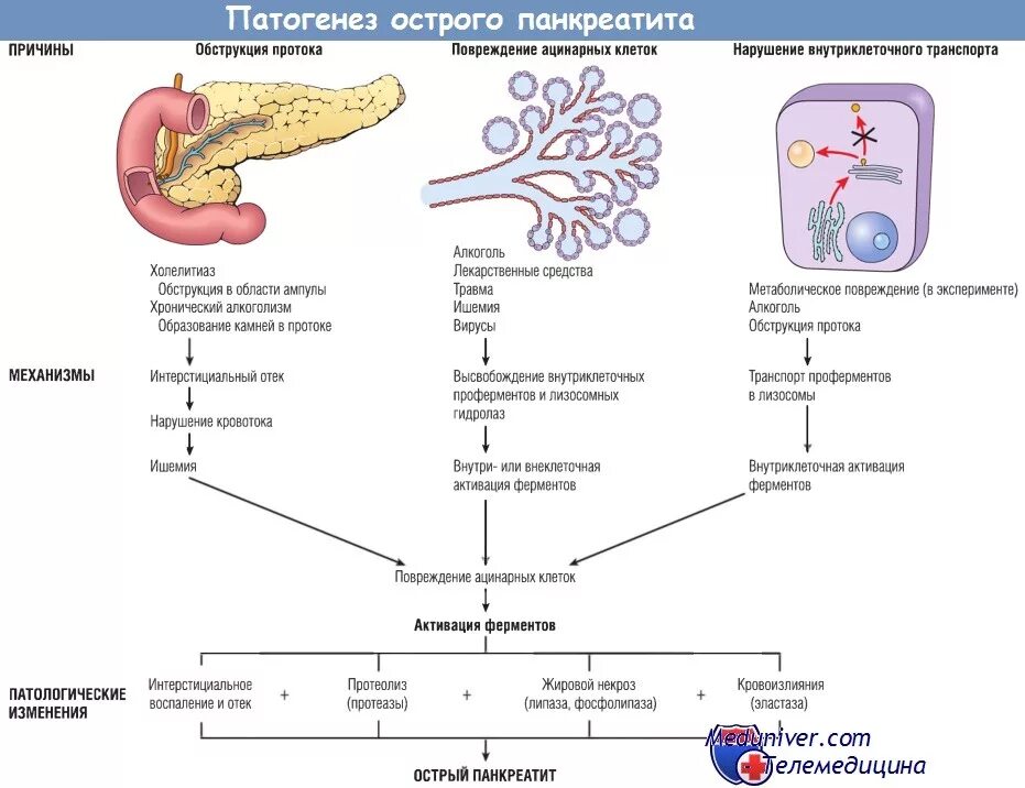 Развитие хронического панкреатита. Патогенетические механизмы острого панкреатита. Алиментарный панкреатит патогенез. Схема развития острого панкреатита. Патогенез острого и хронического панкреатита.