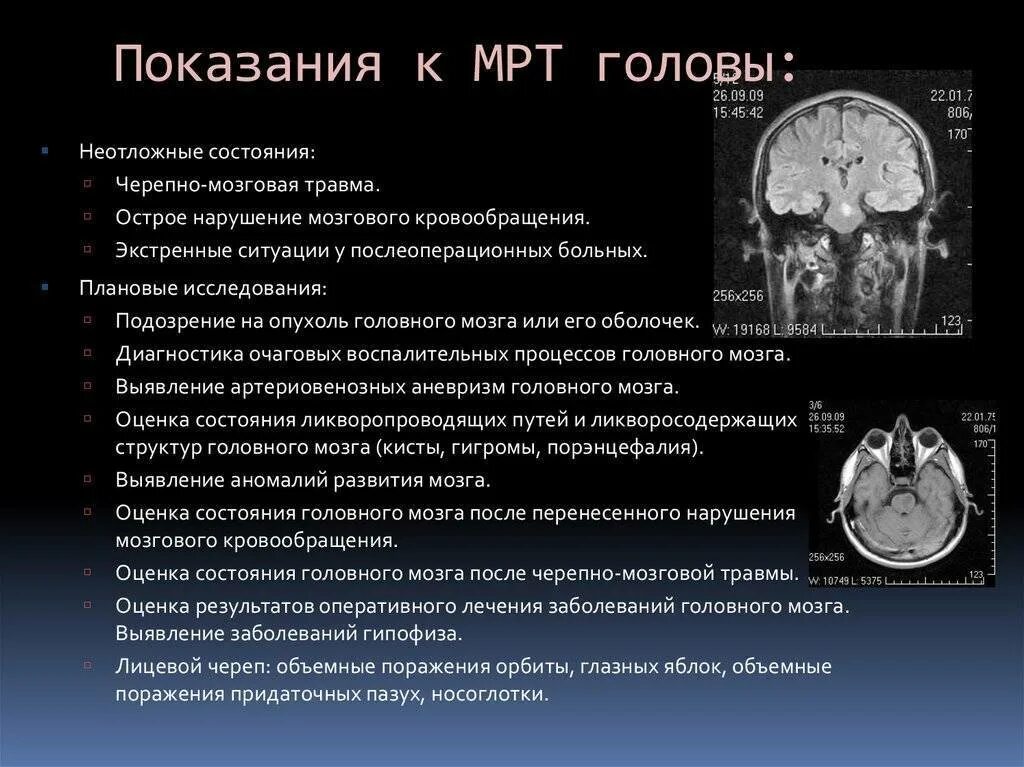 Мрт при каких заболеваниях. Показания к проведению мрт головного мозга. магнитно-резонансная томография головного мозга. показания.. показания к мрт головы. кт головного мозга показания.