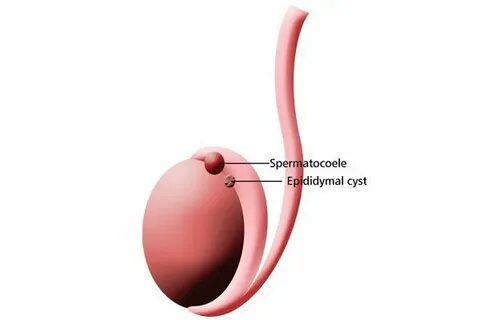 Ұсталып, қатты трафик