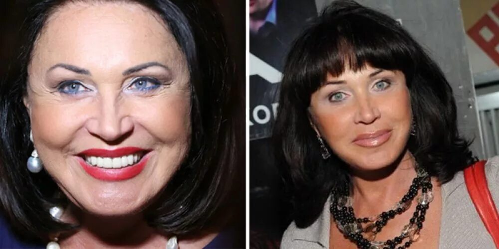 Актрисы с пластикой. Елена воробей до и после. Мария горбань до пластических операций. Жертвы пластических операций. Знаменитости после пластических операций.