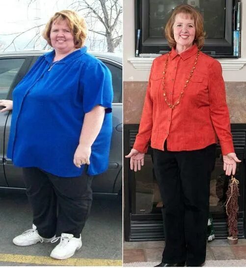 до и после похудения девушки. похудение до и после фото. похудение до и после. похудение до и после. похудевшие женщины после 40.