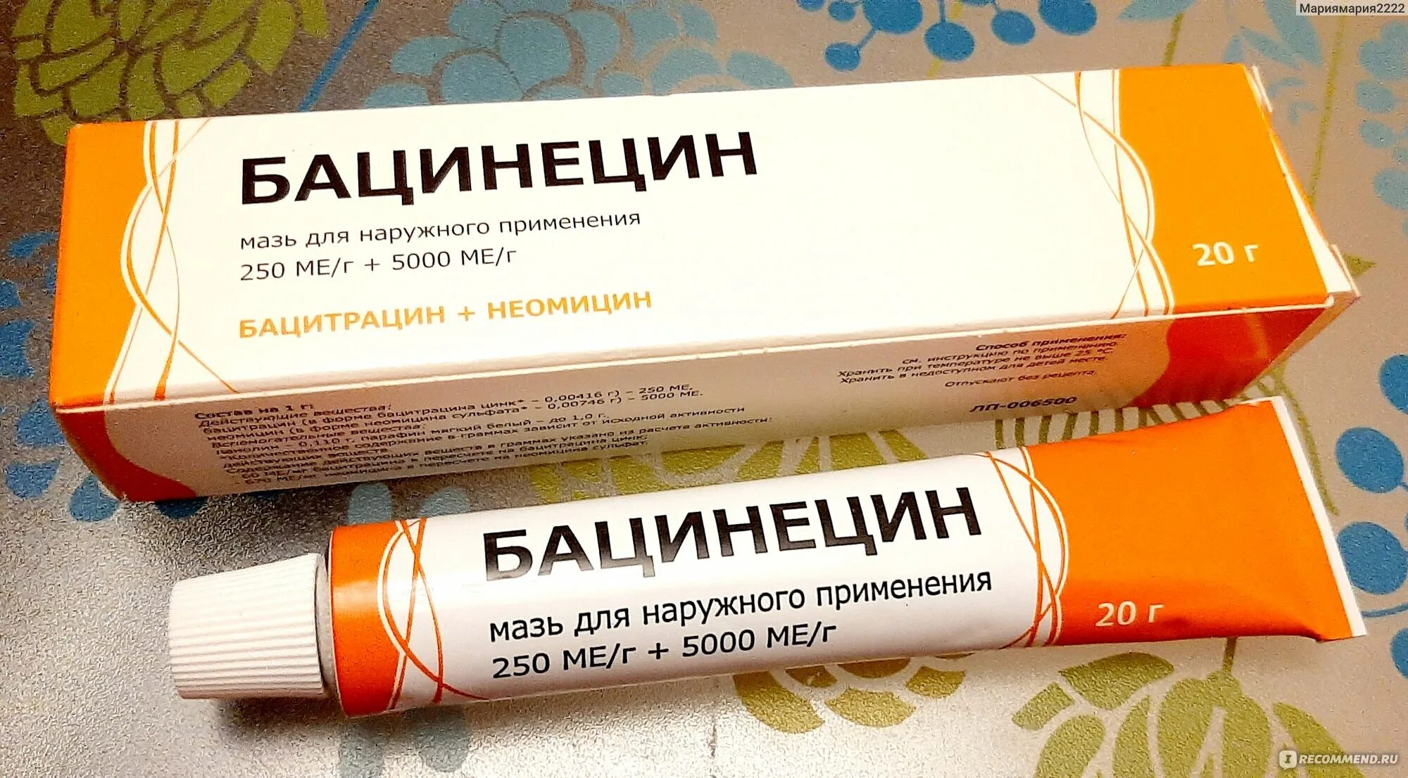 Мазь бетанецин от чего. Бацинецин. мазь для синяка бацинецин. септопластика под общим наркозом.