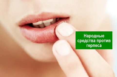 Как срочно избавиться от герпеса