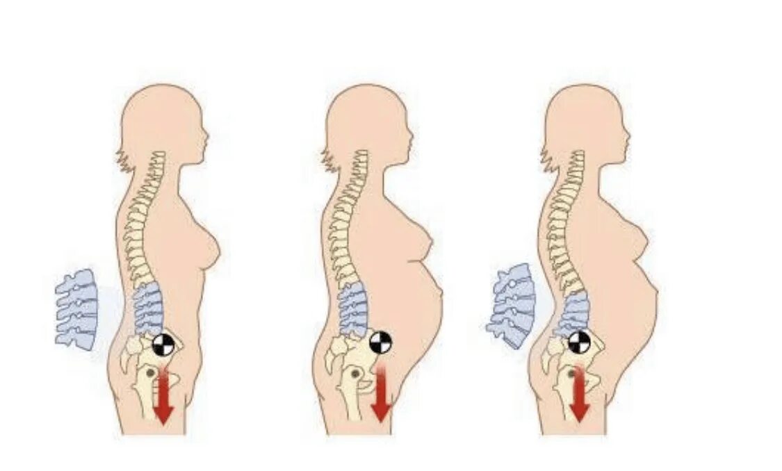 Боли в спине в 3 триместре. Центр тяжести при беременности. Беременность и позвоночник. Лордоз после беременности. Изменение центра тяжести при беременности.