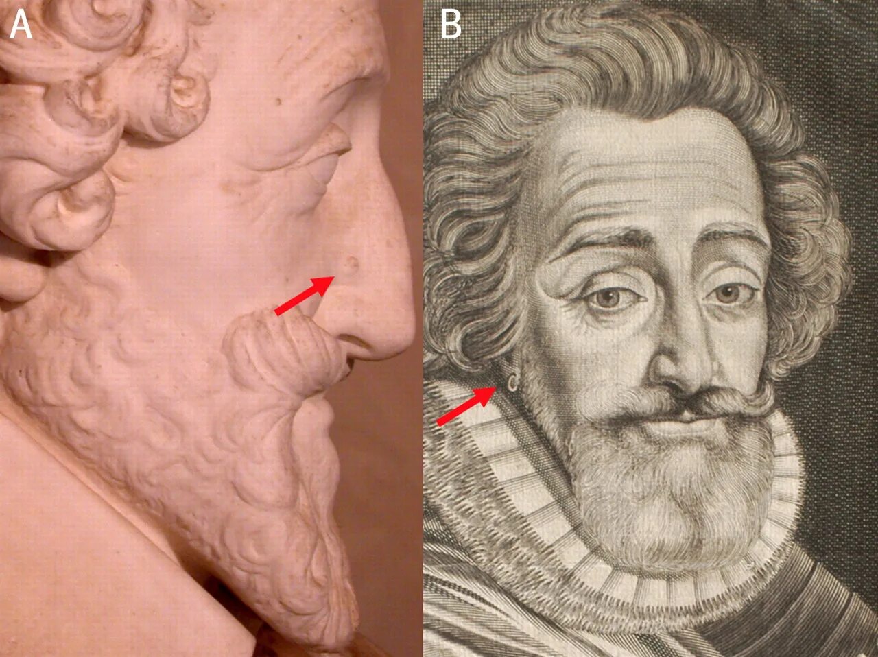 Второй лоб. Голова Генриха 4 Наваррского. Портрет Генриха 4 Наваррского.