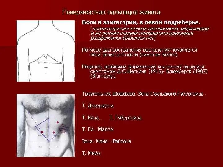 Боль в эпигастрии отдает. Точка Мейо Робсона 2. Болевые точки живота спереди. Симптомы поджелудочной железы Мейо Робсона. Пальпация поджелудочной железы метод Гротта.