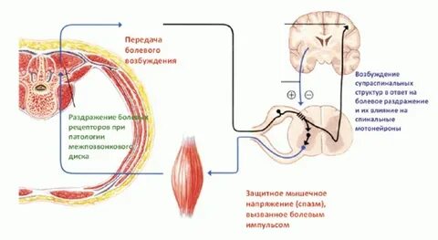 Спазм гладких мышц