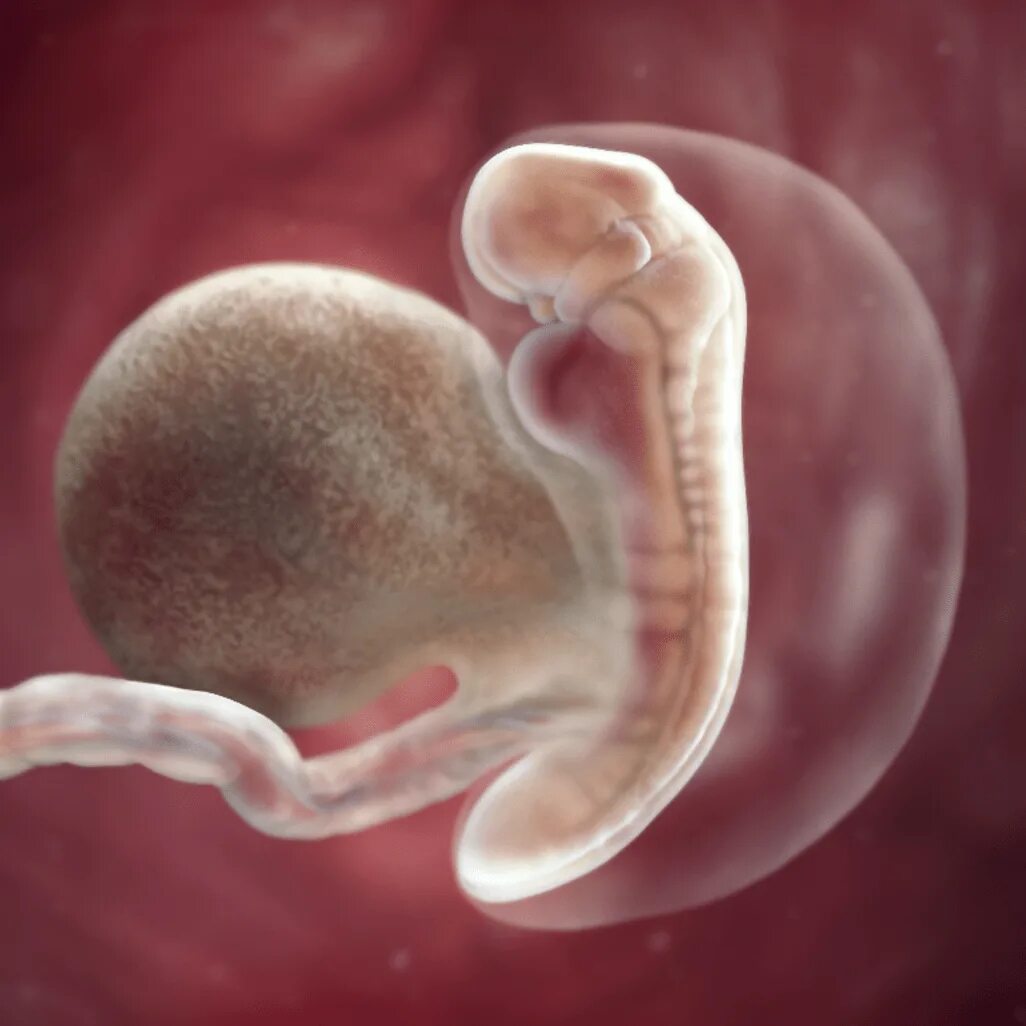 5 акушерская неделя. Эмбрион на 5 неделе беременности. 5 Акушерских недель беременности фото плода.