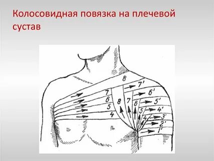 Наложения колосовидной повязки на сустав