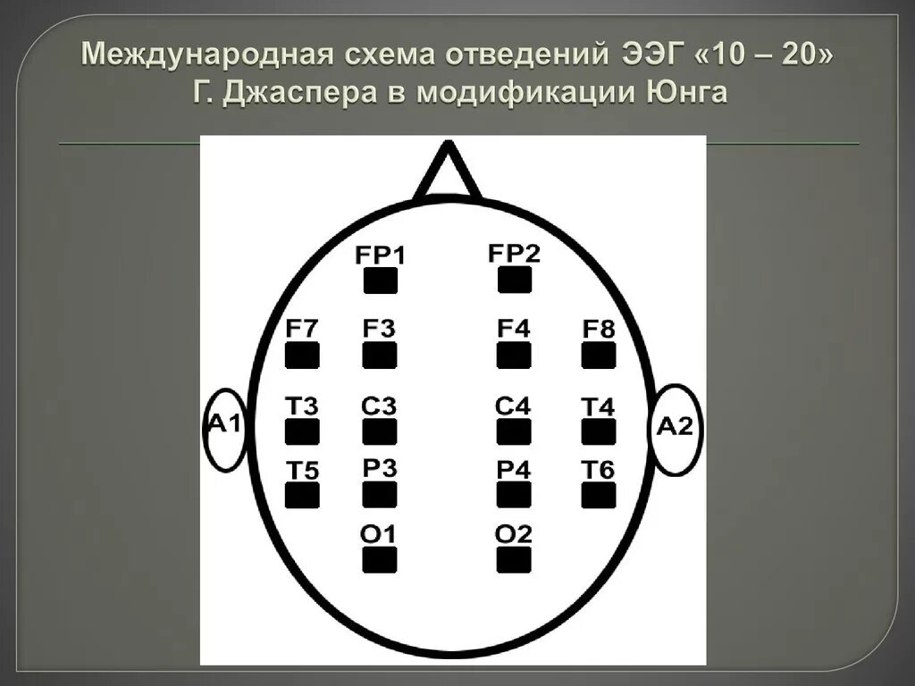 Ээг 10 10. Схема расположения электродов при ЭЭГ 10-20. Расположение электродов 10-20. Схема наложения электродов ЭЭГ. Схема 10-20 наложение электродов.