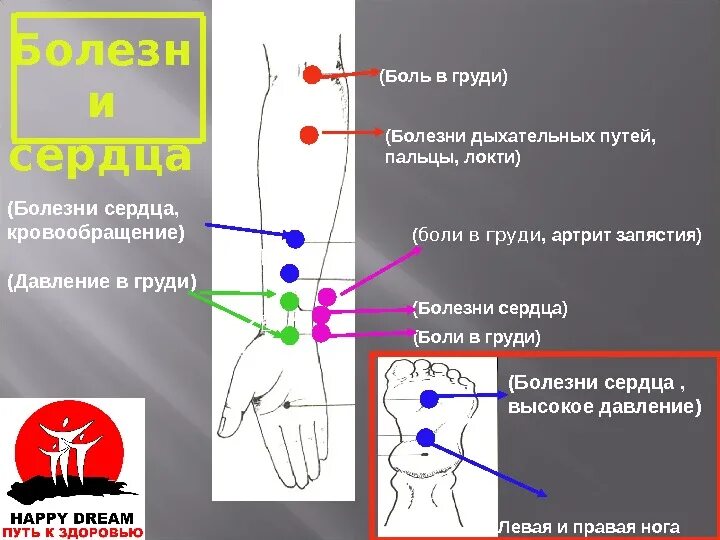 Точки болезненности. Массаж при болях в сердце точки. Точки при сердечной боли. Точки для снятия боли в сердце. Точечный массаж при боли в се.