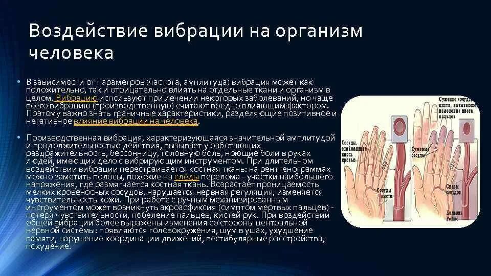 Воздействие вибрации на организм человека. Вибрация воздействует на. Влияние вибраций. Воздействие общей вибрации на человека.