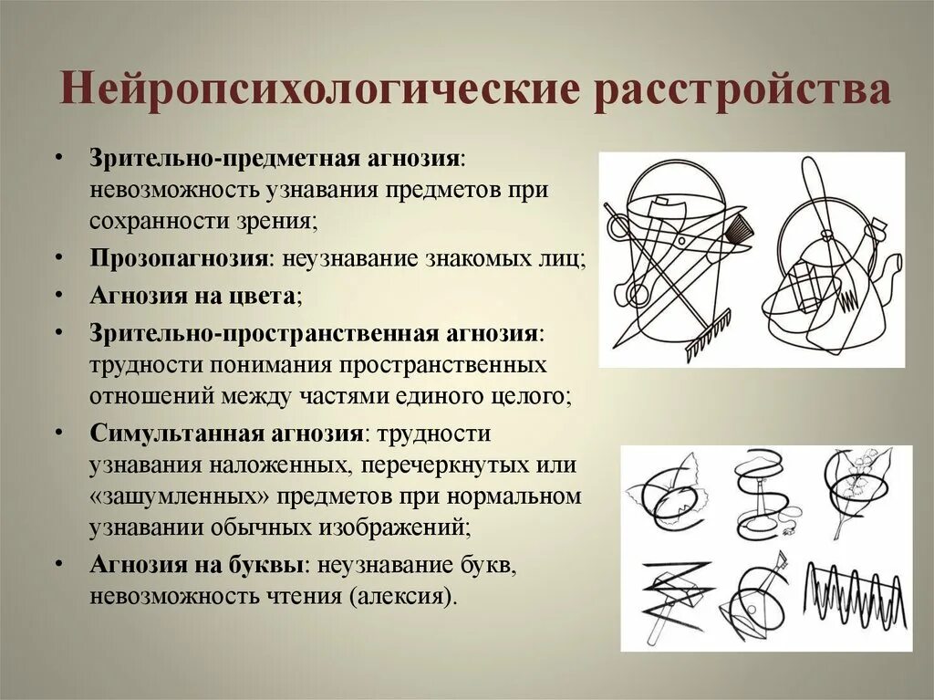 Ассоциативная операция. Коррекция зрительной агнозии упражнения. Проба Поппельрейтера методика. Симультанная Зрительная агнозия. Узнавание наложенных изображений.