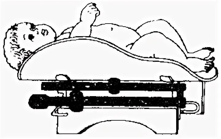 Измерение массы тела возраст старше 2 лет. Измерение длины тела у детей до года. Проведение антропометрии измерение веса. Измерение массы тела новорожденного алгоритм. Вес ребенка алгоритм.