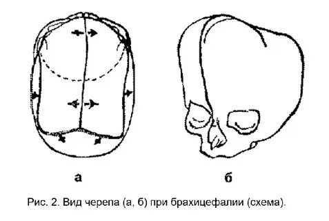 Брахиоцефалия