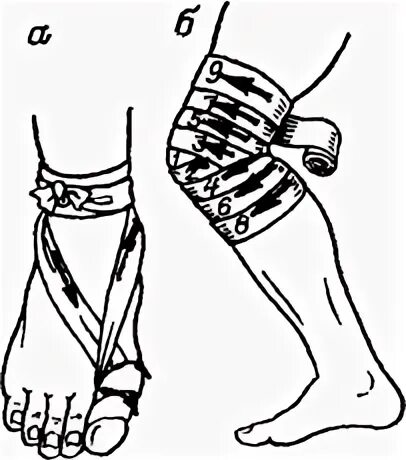 Техника наложения эластичного. Эластичное бинтование нижних конечностей. Бинтование коленного сустава эластичным бинтом. Бинтование голеностопа эластичным бинтом. Бинтование конечности эластичным бинтом алгоритм.