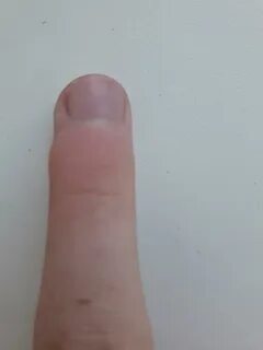 Косточки на указательном пальце руки