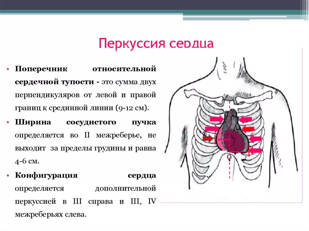 Границы относительной тупости сердца в норме. Топографическая перкуссия сердца. Определение верхней границы относительной сердечной тупости. Перкуссия сердца норма вывод. Длинник и поперечник