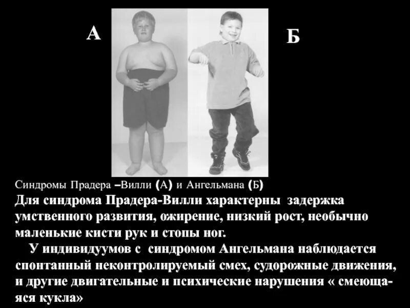 Синдром лоуренса муна барде бидля. Синдром лоуренса муна барде бидля