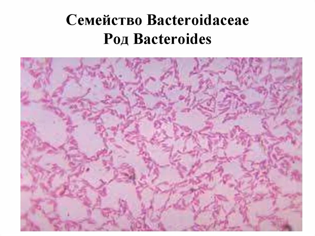 Fusobacterium spp. Bacteroides spp микроскопия. бактероиды фрагилис bacteroides fragilis. бактероиды (род bacteroides. bacteroides fragilis по граму.