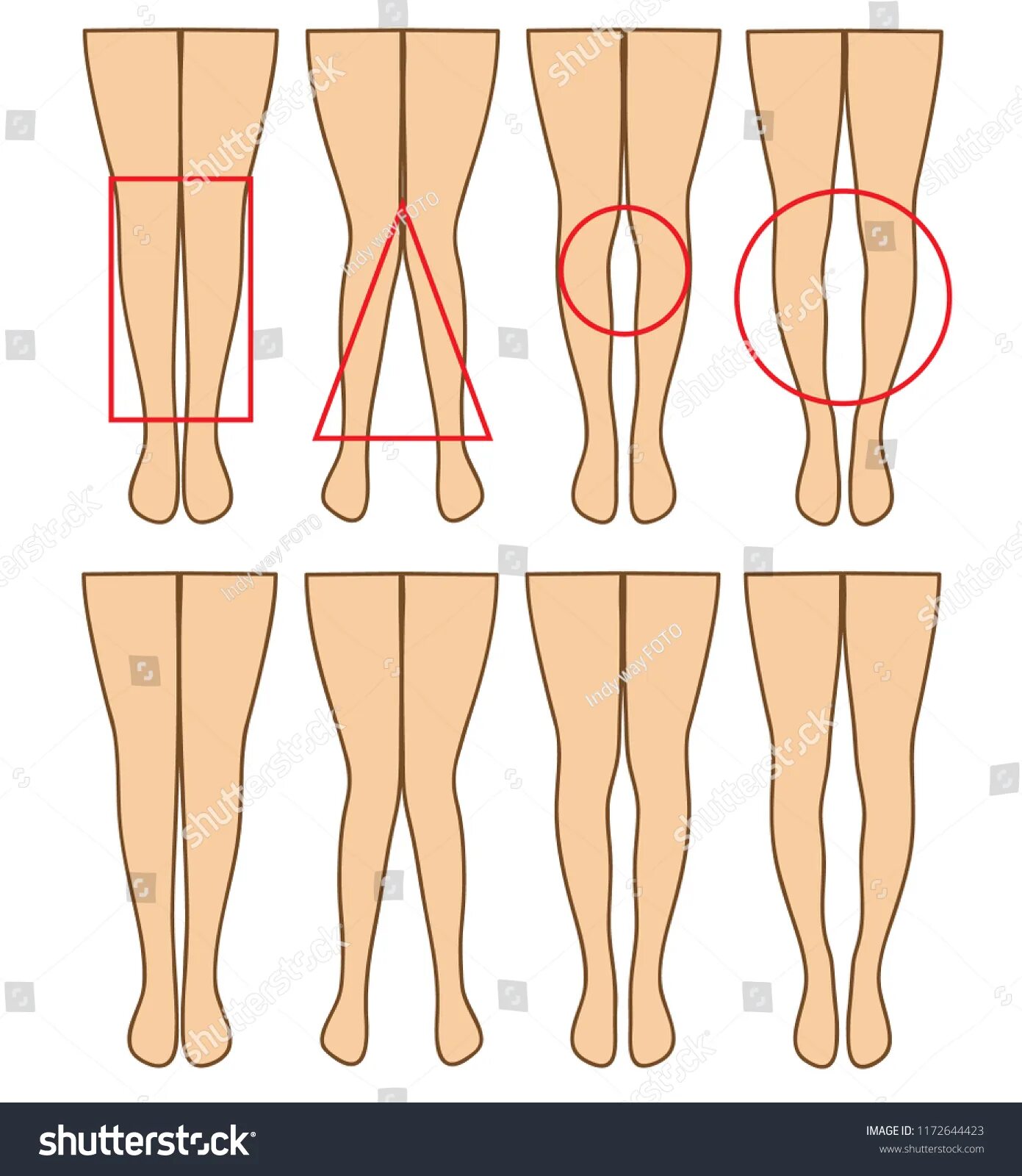Types of Legs. Types of Legs Hip Replacement. Leg curvature Types. O leg o