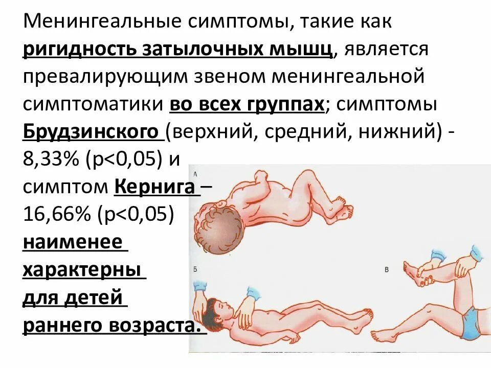 Тест на менингит. Менингококковая инфекция симптом Кернига. Менингеальные симптомы у грудничка до года. Менингиальныесимптомы это. Менингит симптомы у детей 1 год.