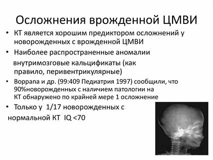 Врожденная цитомегаловирусная инфекция тест