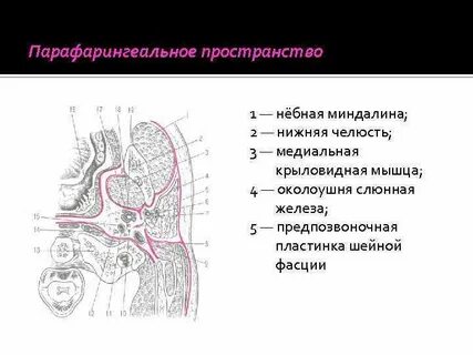 Небные миндалины на кт