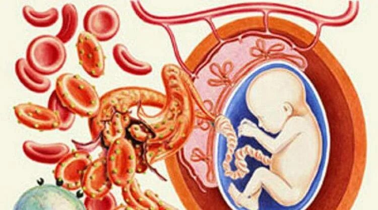 Передача от матери к плоду. Гемолитическая болезнь новорожденных резус фактор. Инфекции от матери к плоду.