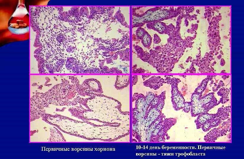 Синцитиотрофобласт гистология. Цитотрофобласт гистология. Ворсины трофобласта. Первичные вторичные и третичные ворсинки хориона. Вторичные ворсинки хориона.