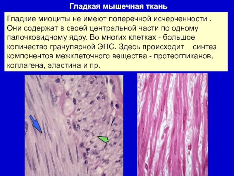Наличием поперечной исчерченности обилием межклеточного