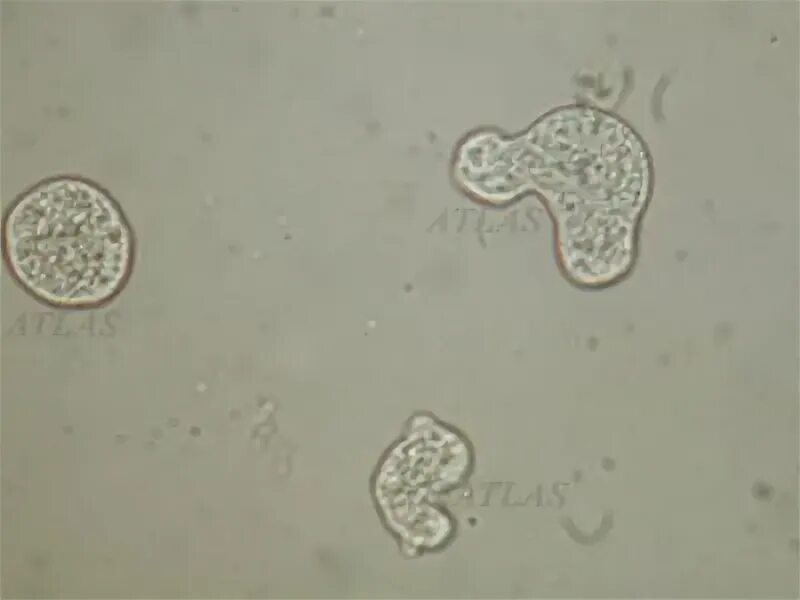 Entamoeba histolytica микроскопия. Цисты Entamoeba. Амеба гистолитика микроскопия кала. Entamoeba coli в кале