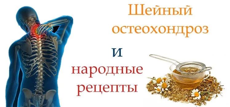 Народные средства при остеохондрозе. Профилактика остеохондроза шейного отдела. Упражнения при грудном остеохондрозе. Остеохондроз позвоночника народными средствами. Шейный остеохондроз народное лечение.