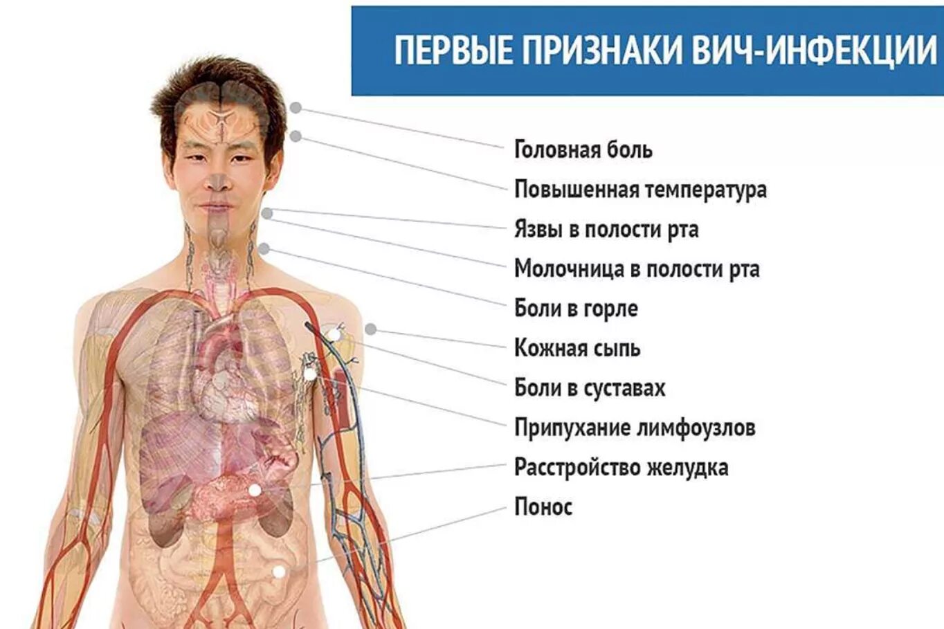 Может ли человек болеть. Симптомы заболевания ВИЧ. Основные симптомы ВИЧ инфекции. ВИЧ симптомы у женщин первые ранние.