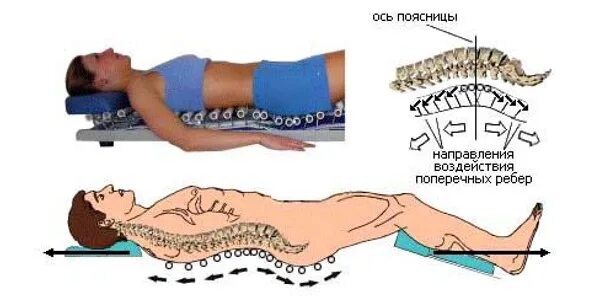 Вытянуть позвоночник. Доска евминова поясничный отдел позвоночника. Доска евминова упражнения для позвоночника. Атланта вытяжение позвоночника. Доска для растяжки позвоночника евминова.