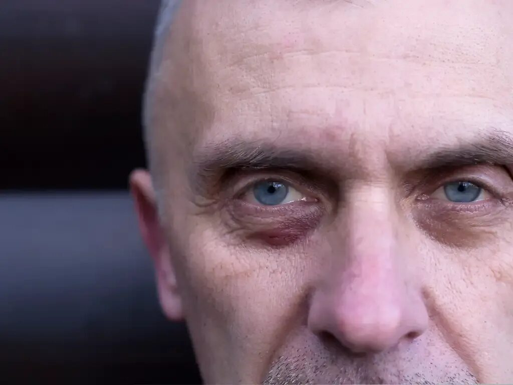 Масоны глаз синяк. Иллюминаты в реальной жизни. Звезда масонов. Папа римский око иллюминатов. Иллюминаты среди знаменитостей.