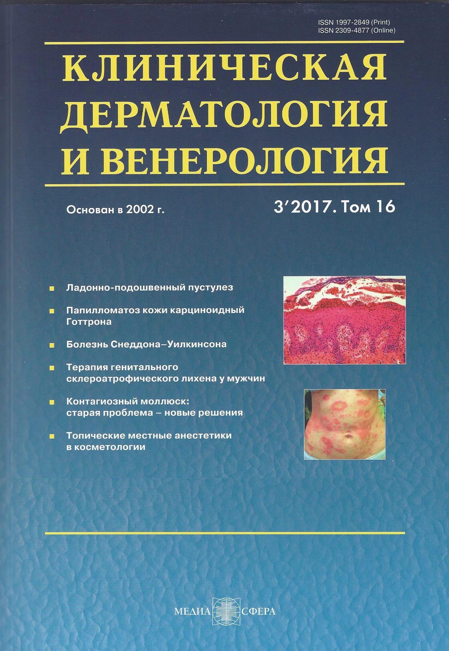 клиническая дерматовенерология. схема лечения акне средней степени тяжести. федеральные клинические рекомендации по дерматовенерологии. топические ретиноиды препараты при акне. стандарты в пульмонологии.