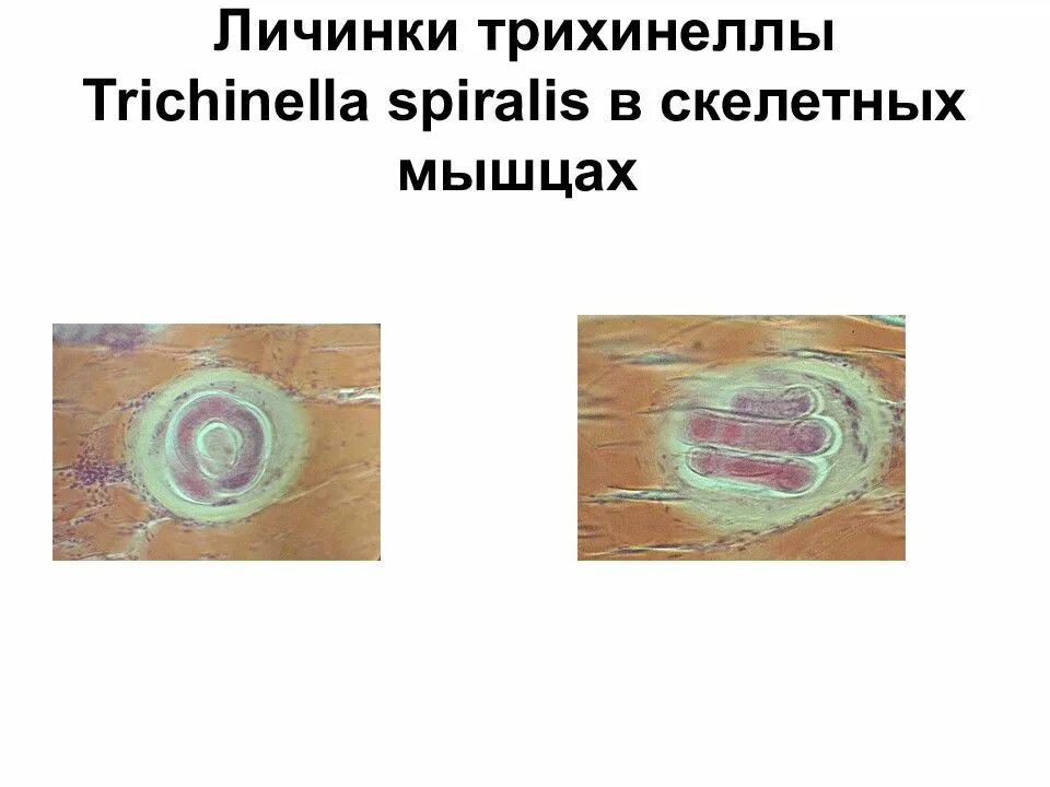 Форма личинки трихинеллы. Морфология трихинеллы Trichinella spiralis. Trichinella spiralis строение. Размер личинки трихинеллы.