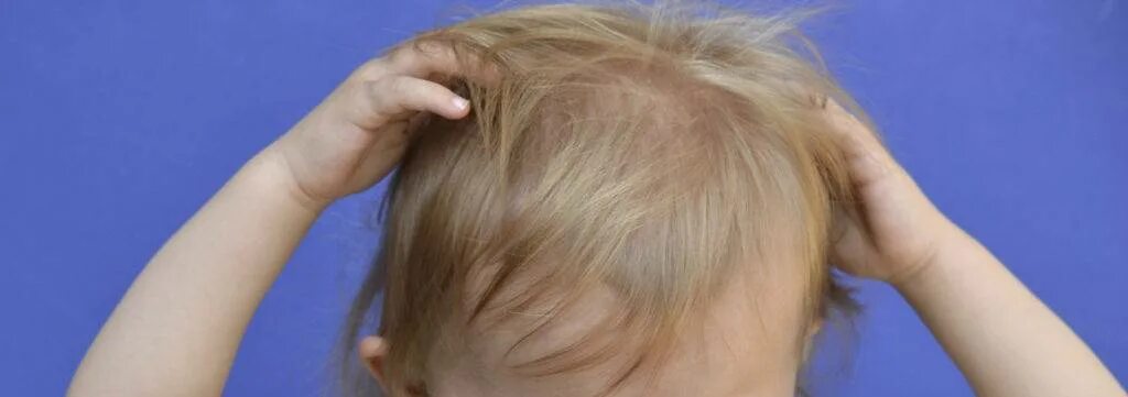 Ребенок расчесывает голову. У ребенка чешется голова и ухо. Чешется голова у ребенка причины.
