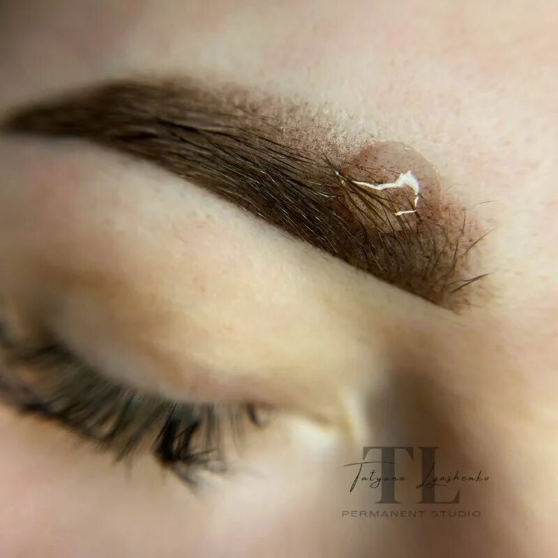 удалена воронеж